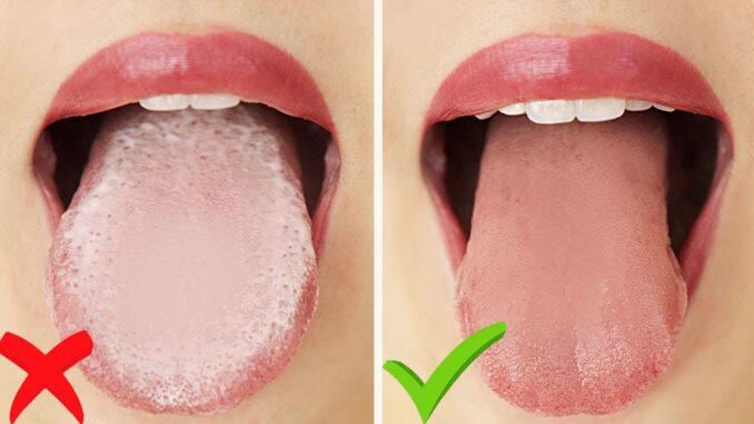 how to clean your tongue